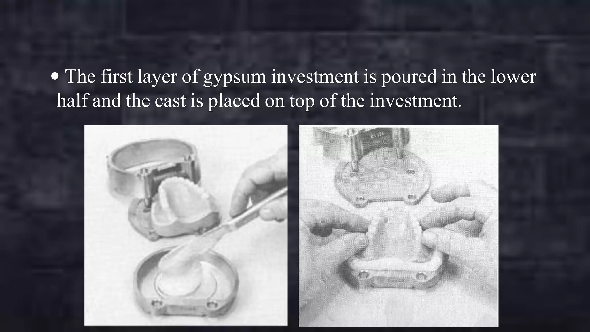 The first layer of gypsum investment is poured in the lower

half and the cast is placed on top of the investment.

 