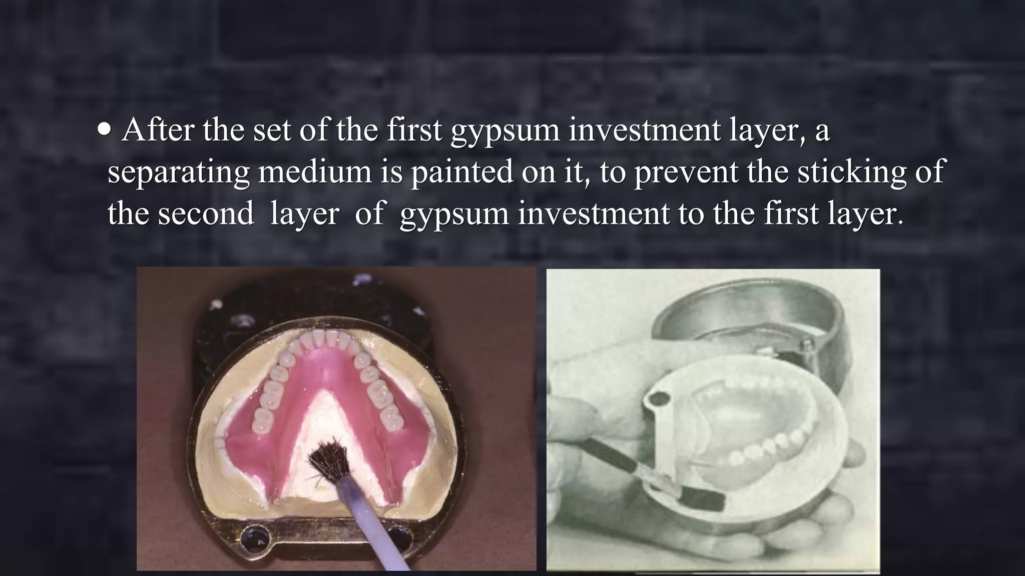  After the set of the first gypsum investment layer, a

separating medium is painted on it, to prevent the sticking of
the second layer of gypsum investment to the first layer.

 
