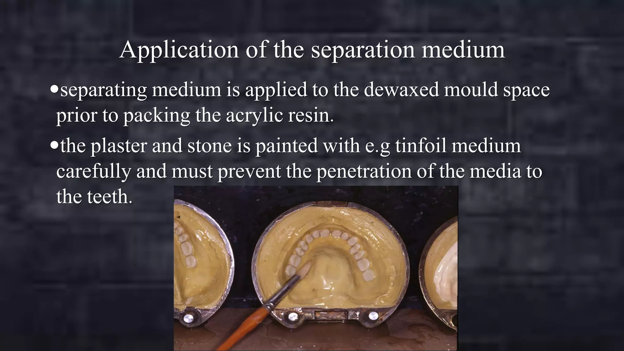 Application of the separation medium
separating medium is applied to the dewaxed mould space

prior to packing the acrylic resin.
the plaster and stone is painted with e.g tinfoil medium
carefully and must prevent the penetration of the media to
the teeth.

 