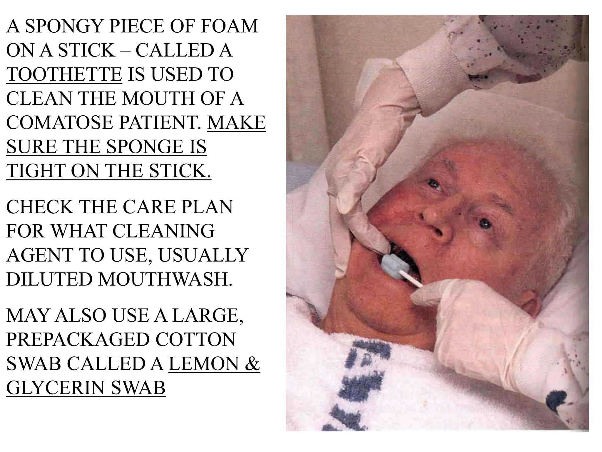 A SPONGY PIECE OF FOAM
ON A STICK – CALLED A
TOOTHETTE IS USED TO
CLEAN THE MOUTH OF A
COMATOSE PATIENT. MAKE
SURE THE SPONGE IS
TIGHT ON THE STICK.
CHECK THE CARE PLAN
FOR WHAT CLEANING
AGENT TO USE, USUALLY
DILUTED MOUTHWASH.
MAY ALSO USE A LARGE,
PREPACKAGED COTTON
SWAB CALLED A LEMON &
GLYCERIN SWAB
 