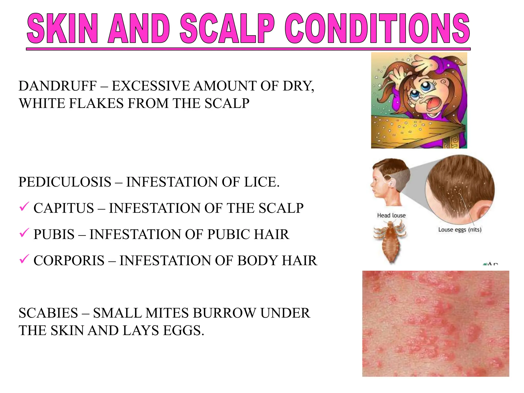 DANDRUFF – EXCESSIVE AMOUNT OF DRY,
WHITE FLAKES FROM THE SCALP
PEDICULOSIS – INFESTATION OF LICE.
 CAPITUS – INFESTATION OF THE SCALP
 PUBIS – INFESTATION OF PUBIC HAIR
 CORPORIS – INFESTATION OF BODY HAIR
SCABIES – SMALL MITES BURROW UNDER
THE SKIN AND LAYS EGGS.
 