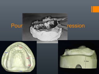 Pouring of Primary Impression