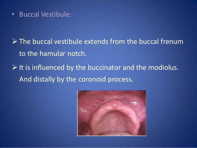 hamular notch