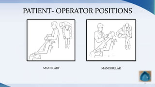 PATIENT- OPERATOR POSITIONS
23
MAXILLARY MANDIBULAR
 