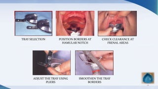 24
TRAY SELECTION POSITION BORDERS AT
HAMULAR NOTCH
CHECK CLEARANCE AT
FRENAL AREAS
ADJUST THE TRAY USING
PLIERS
SMOOTHEN THE TRAY
BORDERS
 