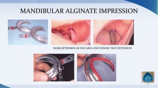 MANDIBULAR ALGINATE IMPRESSION
28
MARK RETROMOLAR PAD AREA AND ENSURE TRAY EXTENSION
 