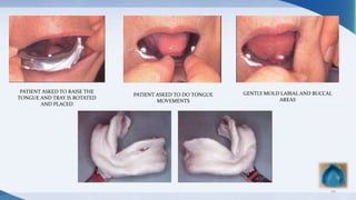 29
PATIENT ASKED TO DO TONGUE
MOVEMENTS
GENTLY MOLD LABIAL AND BUCCAL
AREAS
PATIENT ASKED TO RAISE THE
TONGUE AND TRAY IS ROTATED
AND PLACED
 