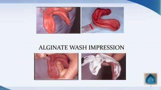 31
ALGINATE WASH IMPRESSION
 