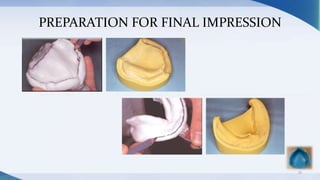 PREPARATION FOR FINAL IMPRESSION
33
 