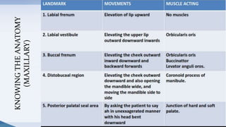 48
KNOWINGTHEANATOMY
(MAXILLARY)
 