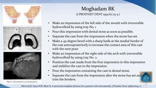 Moghadam BK
(J PROSTHET DENT 1992;67:23-5.)
• Make an impression of the left side of the mouth with irreversible
hydrocolloid by using tray No. 1
• Pour this impression with dental stone as soon as possible.
• Separate the cast from the impression when the stone has set.
• Make a 45-degree bevel with a sharp knife at the medial border of
the cast anteroposteriorly to increase the contact area of this cast
with the next pour
• Make an impression of the right side of the arch with irreversible
hydrocolloid by using tray No. 2.
• Position the cast made from the first impression in this impression
and stabilize the cast in the impression.
• Pour the impression containing the cast in dental stone.
• Separate the cast from the impression after the stone has set and
trim the borders.
85
McCord JF, Tyson KW, Blair IS. A sectional complete denture for a patient with microstomia. J Prosthet Dent 1989;61:645–7.
 