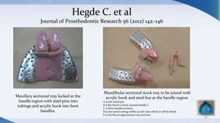 88
Mandibular sectional stock tray to be joined with
acrylic hook and steel bur at the handle region.
A is the metal pin
B is the bend to hook around handle C
C is bent handle sections
D is the metal tubing within acrylic into which A will be ﬁtted
E is the ﬁns to approximate tray sections
Maxillary sectional tray locked at the
handle region with steel pins into
tubings and acrylic hook into bent
handles.
Hegde C. et al
Journal of Prosthodontic Research 56 (2012) 142–146
 