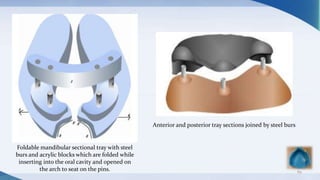 89
Foldable mandibular sectional tray with steel
burs and acrylic blocks which are folded while
inserting into the oral cavity and opened on
the arch to seat on the pins.
Anterior and posterior tray sections joined by steel burs
 