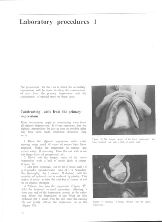 Complete denture prosthetics | PDF
