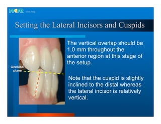 Complete dentures 16.occlusal schemes lingualized occlusion | PDF