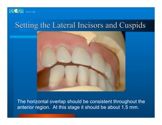 Complete dentures 16.occlusal schemes lingualized occlusion | PDF
