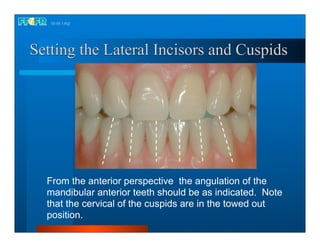 Complete dentures 16.occlusal schemes lingualized occlusion | PDF