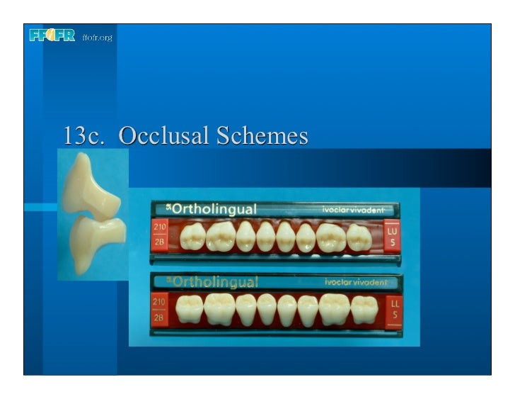 Complete dentures 16.occlusal schemes lingualized occlusion