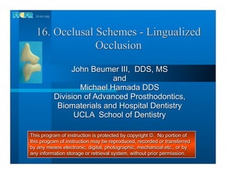 16. Occlusal Schemes - Lingualized
               Occlusion

               John Beumer III, DDS, MS
                           and
                  Michael Hamada DDS
          Division of Advanced Prosthodontics,
           Biomaterials and Hospital Dentistry
                UCLA School of Dentistry

This program of instruction is protected by copyright ©. No portion of
this program of instruction may be reproduced, recorded or transferred
by any means electronic, digital, photographic, mechanical etc., or by
any information storage or retrieval system, without prior permission.
 