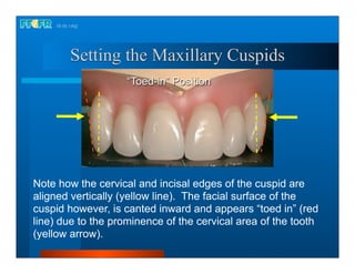 Complete dentures 16.occlusal schemes lingualized occlusion | PDF
