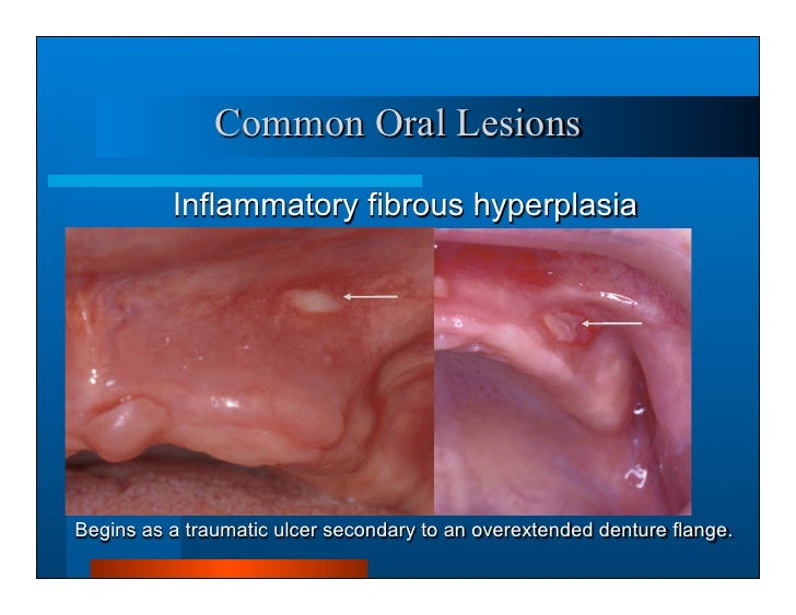 Complete dentures 3.history and exam