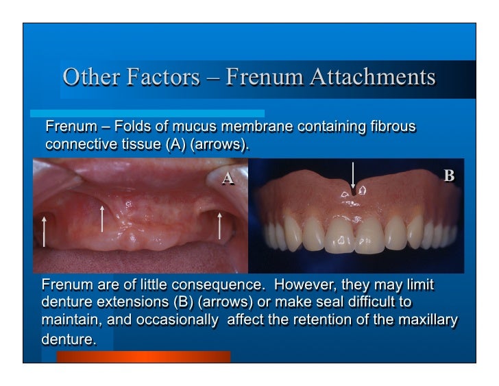 Complete dentures 3.history and exam