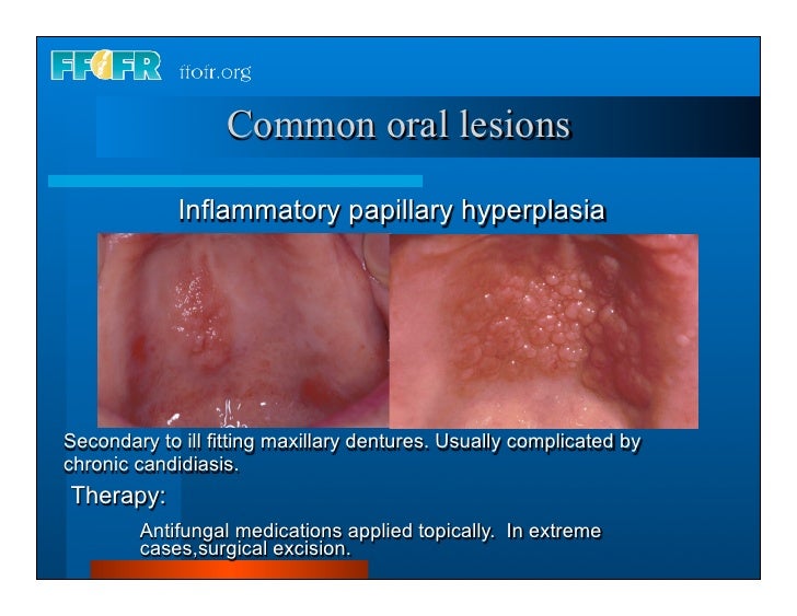 Complete dentures 3.history and exam
