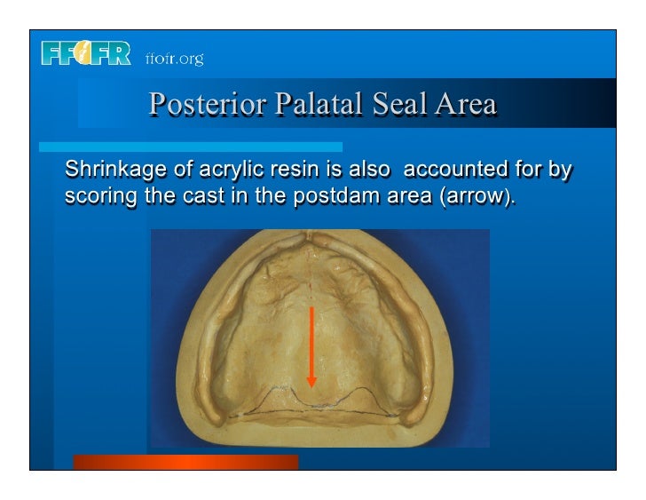 Complete dentures 3.history and exam