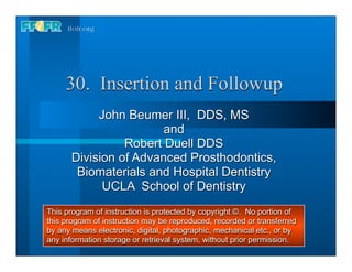 30. Insertion and Followup
           John Beumer III, DDS, MS
                       and
                Robert Duell DDS
      Division of Advanced Prosthodontics,
       Biomaterials and Hospital Dentistry
            UCLA School of Dentistry
This program of instruction is protected by copyright ©. No portion of
this program of instruction may be reproduced, recorded or transferred
by any means electronic, digital, photographic, mechanical etc., or by
any information storage or retrieval system, without prior permission.
 