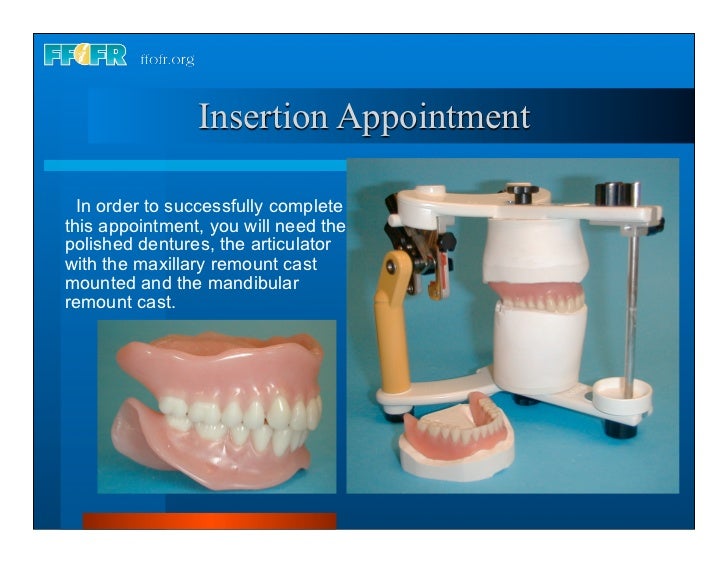 Complete dentures 30. insertion and followup
