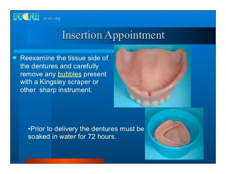Complete dentures 30. insertion and followup