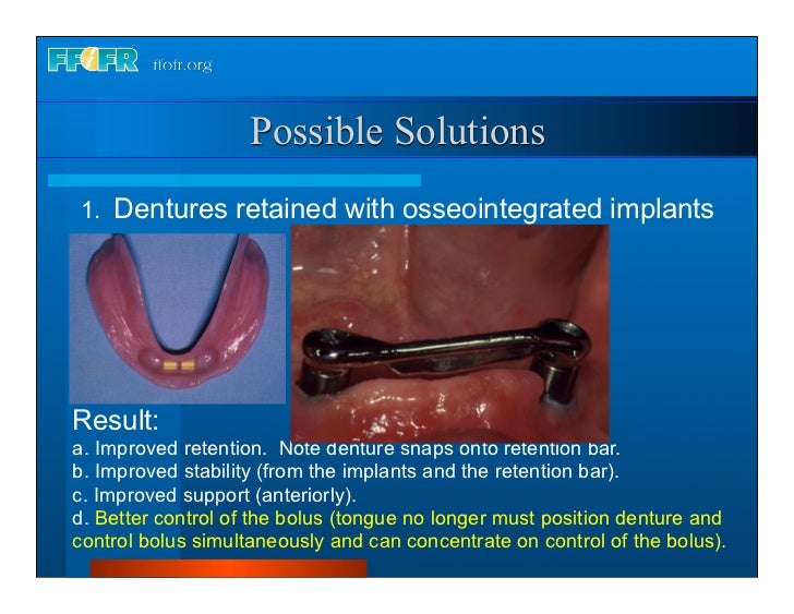 Complete dentures 30. insertion and followup