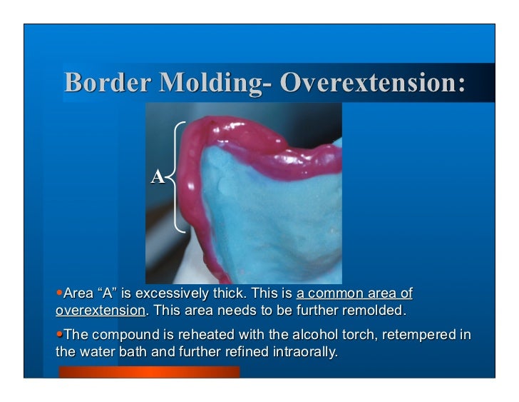 Complete dentures 7. final impressions