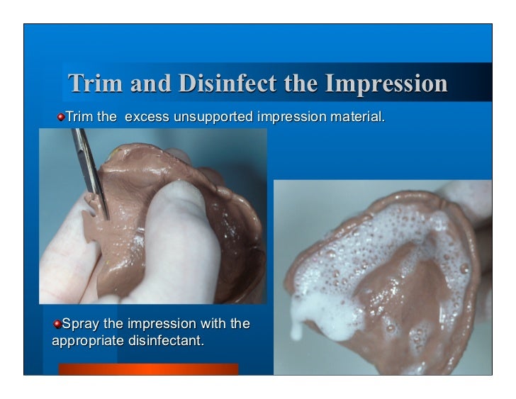 Complete dentures 7. final impressions