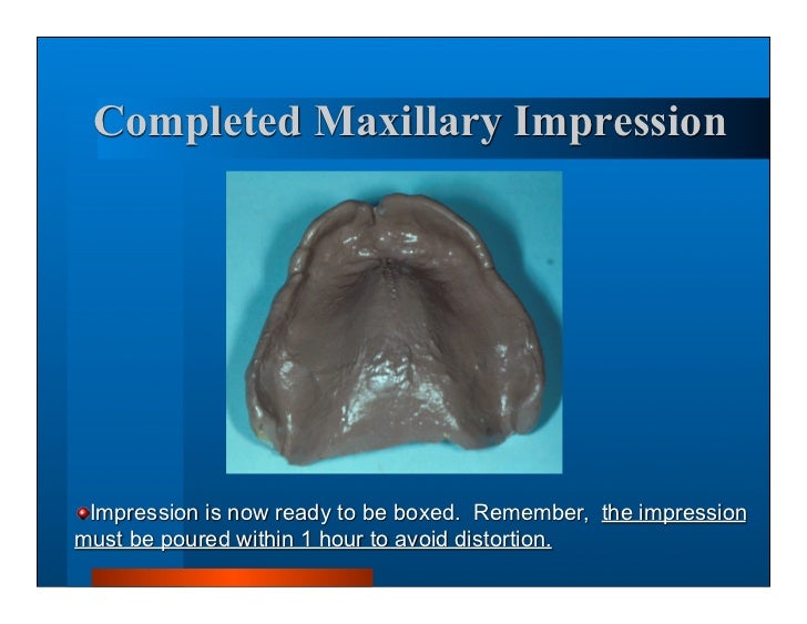 Complete dentures 7. final impressions