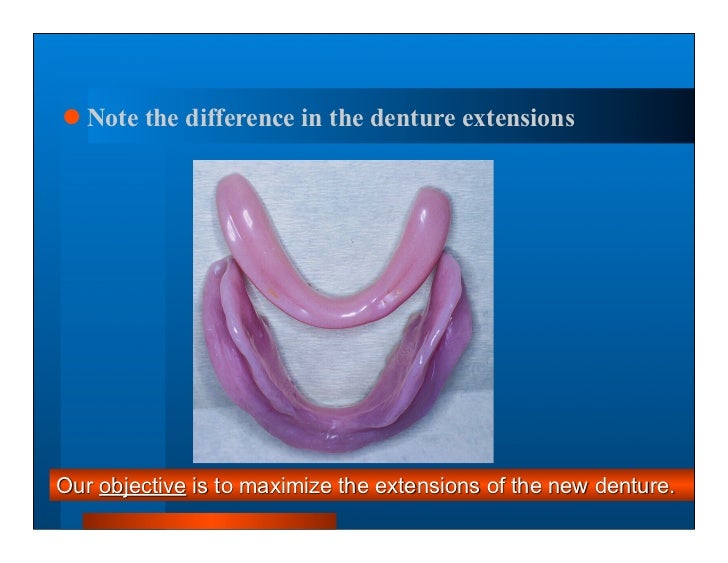 Complete dentures 7. final impressions