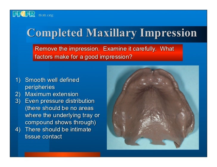 Complete dentures 7. final impressions