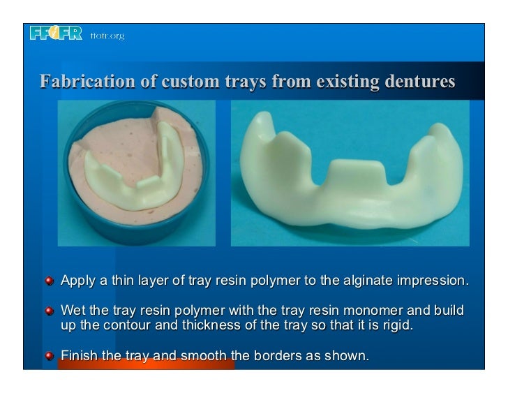 Complete dentures 7. final impressions