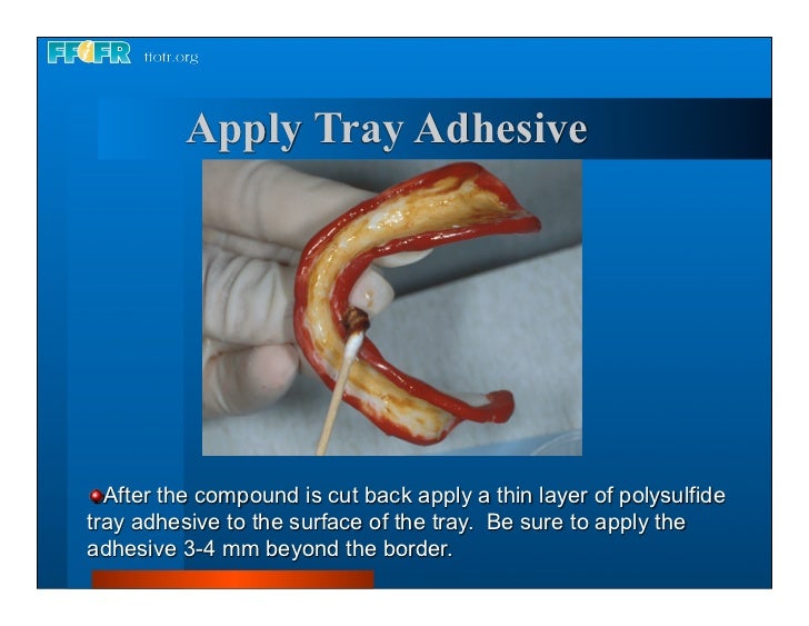 Complete dentures 7. final impressions