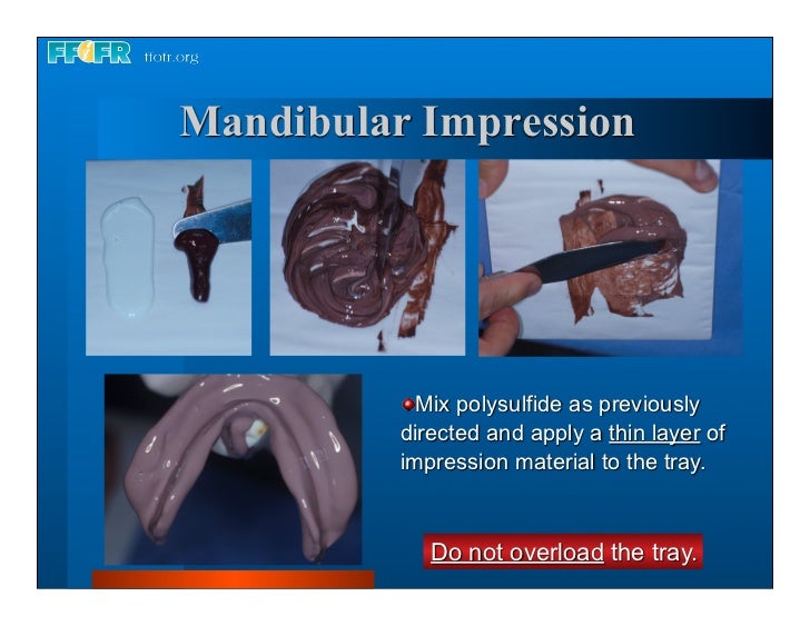 Complete dentures 7. final impressions