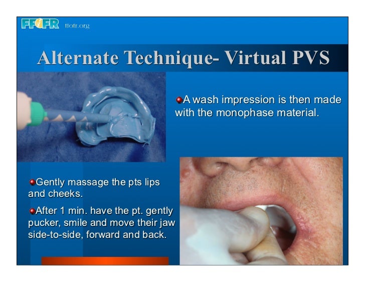 Complete dentures 7. final impressions