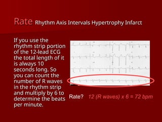complete ECG interpretation presentation.ppt