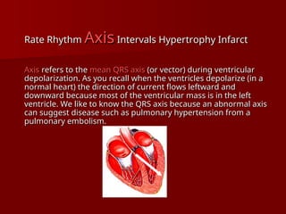 complete ECG interpretation presentation.ppt