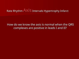 complete ECG interpretation presentation.ppt