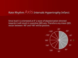 complete ECG interpretation presentation.ppt