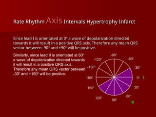 complete ECG interpretation presentation.ppt