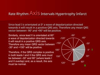 complete ECG interpretation presentation.ppt