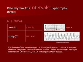 complete ECG interpretation presentation.ppt