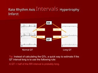 complete ECG interpretation presentation.ppt