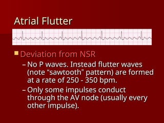 Inverted A Flutter complete ECG interpretation presentation.ppt